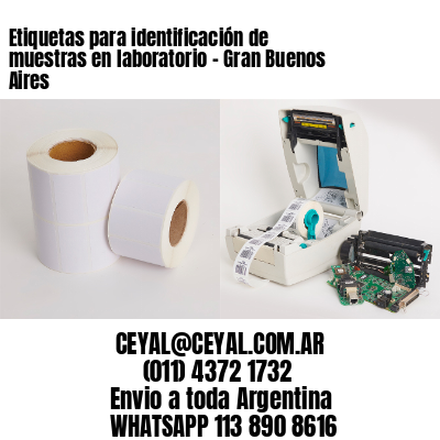 Etiquetas para identificación de muestras en laboratorio – Gran Buenos Aires